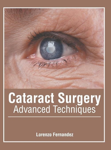 Cataract Surgery: Advanced Techniques