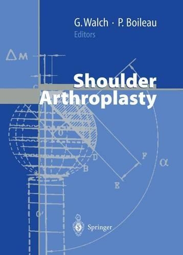 Shoulder Arthroplasty
