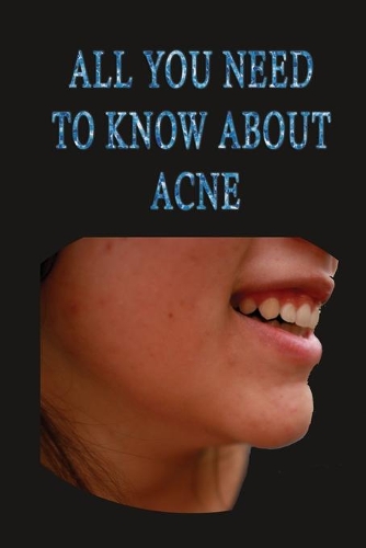 All you need to know about acne