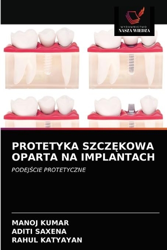 Protetyka SzczĘkowa Oparta Na Implantach