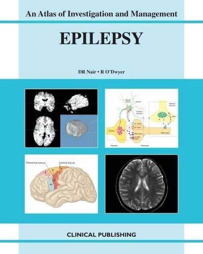 Epilepsy: (Atlas of Investigation and Management)