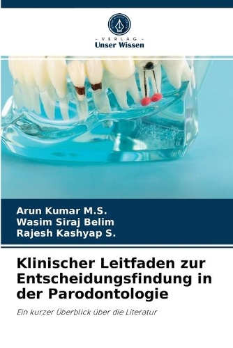 Klinischer Leitfaden zur Entscheidungsfindung in der Parodontologie