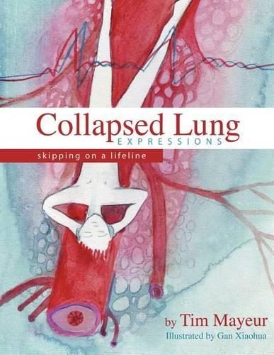 Collapsed Lung Expressions: Skipping on a Lifeline(English)