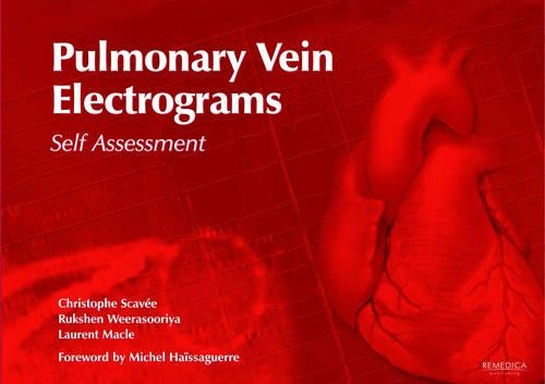 Pulmonary Vein Electrograms