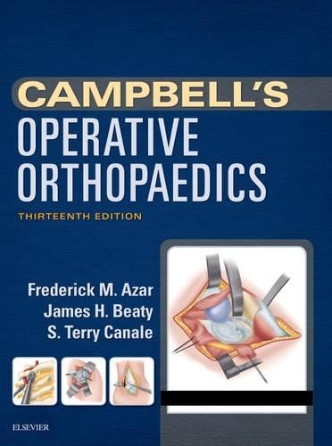 Campbell's Operative Orthopaedics E-Book