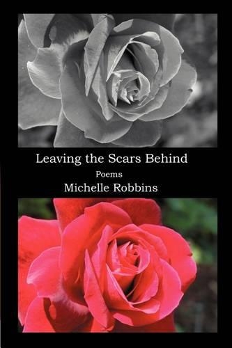 Leaving the Scars Behind: (English)