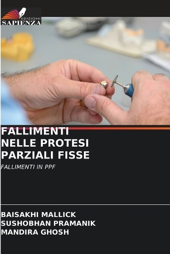 Fallimenti Nelle Protesi Parziali Fisse