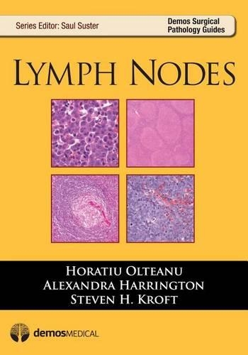 Lymph Nodes: Lymp Nodes
