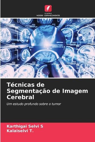 Técnicas de Segmentação de Imagem Cerebral
