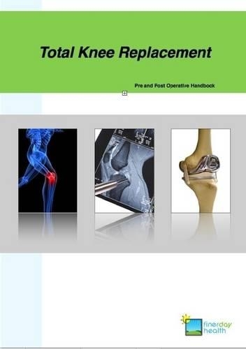 Total Knee Replacement