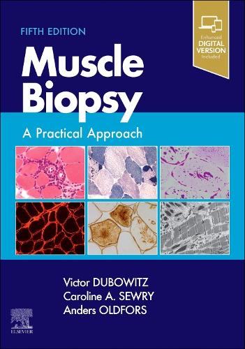 Muscle Biopsy E-Book: A Practical Approach