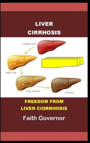 Liver Cirrhosis