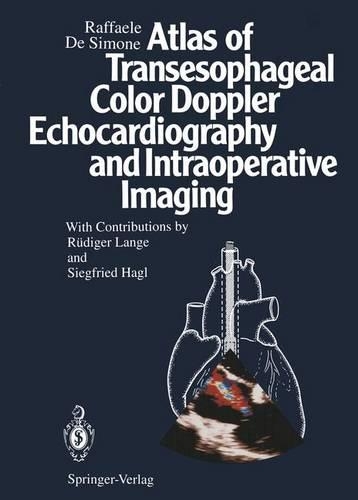Atlas of Transesophageal Color Doppler Echocardiography and Intraoperative Imaging: (English)