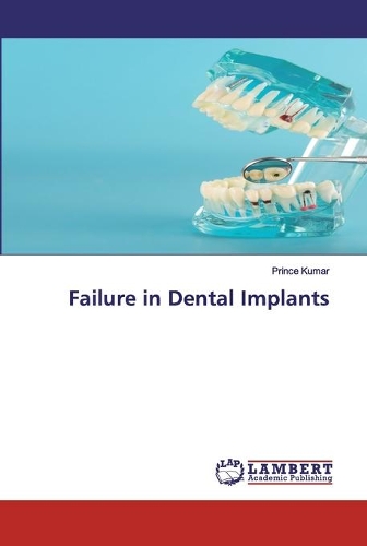 Failure in Dental Implants