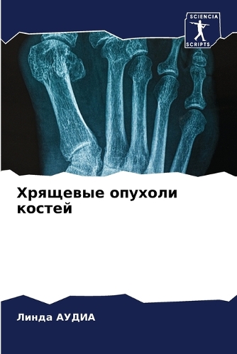 &#1061;&#1088;&#1103;&#1097;&#1077;&#1074;&#1099;&#1077; &#1086;&#1087;&#1091;&#1093;&#1086;&#1083;&#1080; &#1082;&#1086;&#1089;&#1090;&#1077;&#1081;