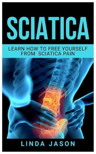 Sciatica