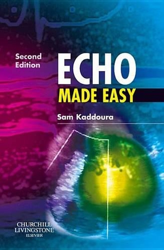 Echo Made Easy E-Book: (Made Easy)