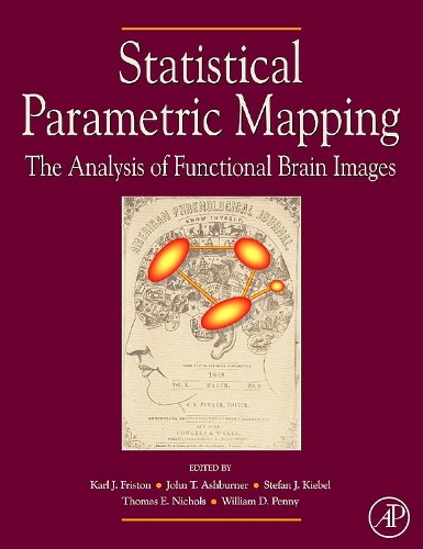 Statistical Parametric Mapping: The Analysis of Functional Brain Images: The Analysis of Functional Brain Images(English)