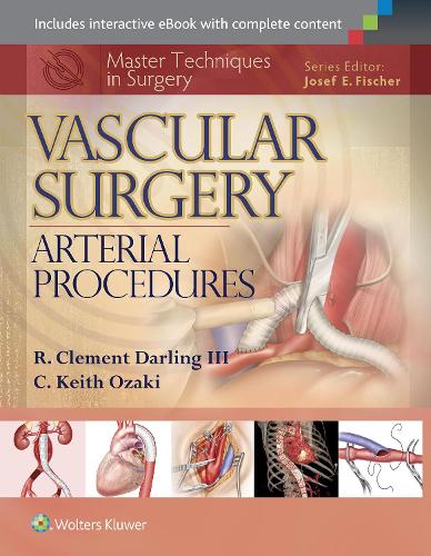 Master Techniques in Surgery: Vascular Surgery: Arterial Procedures: Arterial Procedures(Master Techniques in Surgery)