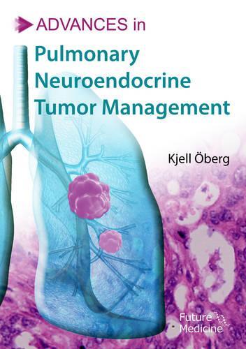 Advances in Pulmonary Neuroendocrine Tumor Management