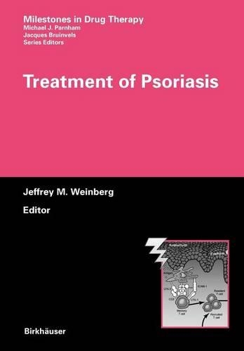 Treatment of Psoriasis: (English)