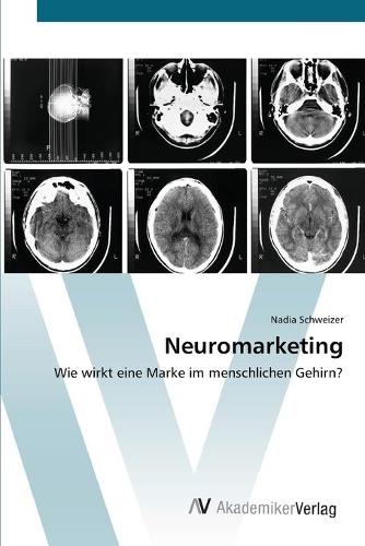 Neuromarketing