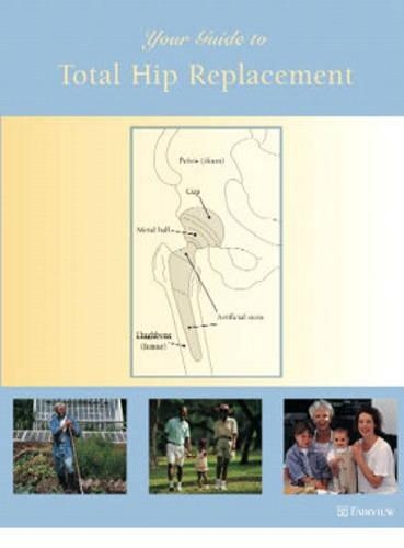 Your Guide to Total Hip Replacement