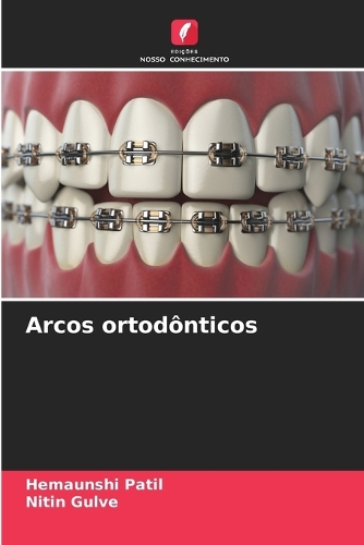 Arcos ortodônticos