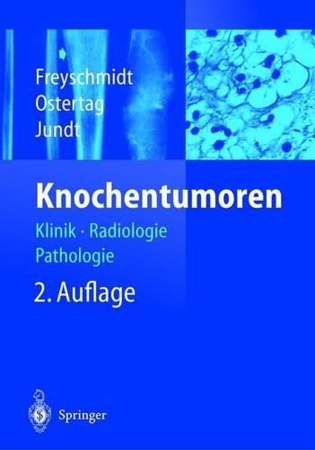 Knochentumoren