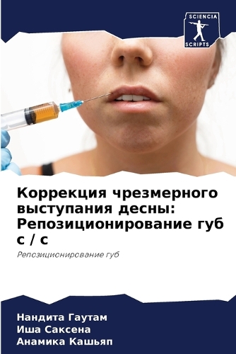 Коррекция чрезмерного выступания десны: ?????????????????? ??? ? / ?