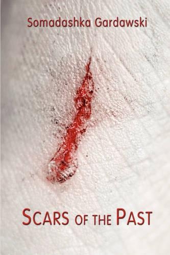 Scars of the Past: (English)