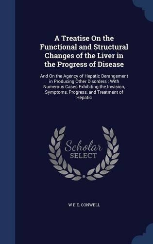 A Treatise on the Functional and Structural Changes of the Liver in the Progress of Disease