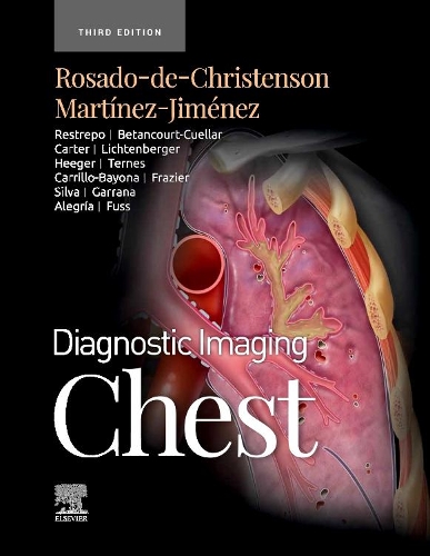 Diagnostic Imaging: Chest - E-Book: Diagnostic Imaging: Chest - E-Book(Diagnostic Imaging)