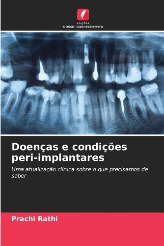 Doenças e condições peri-implantares