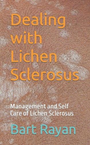 Dealing with Lichen Sclerosus