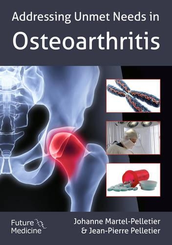 Addressing Unmet Needs in Osteoarthritis