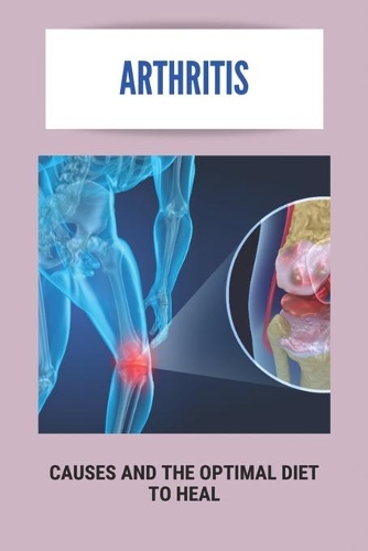 Arthritis: Causes And The Optimal Diet To Heal: What Vegetables Are Bad For Arthritis