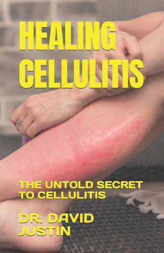 Healing Cellulitis