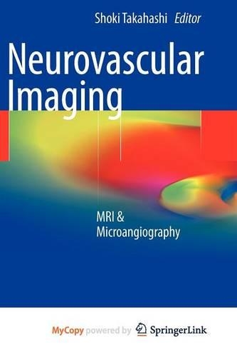 Neurovascular Imaging