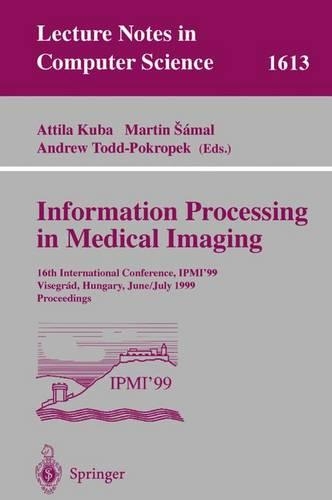 Information Processing in Medical Imaging: 16th International Conference, IPMI'99, Visegrad, Hungary, June 28 - July 2, 1999, Proceedings(1613 Lecture Notes in Computer Science)