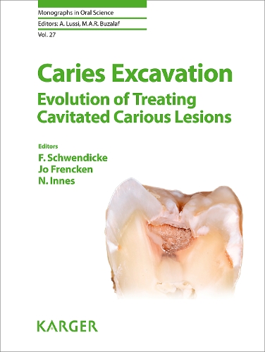 Caries Excavation: Evolution of Treating Cavitated Carious Lesions: (27 Monographs in Oral Science)
