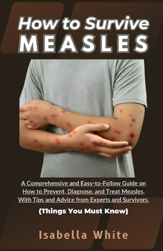 How to Survive Measles: A Comprehensive and Easy-to-Follow Guide on How to Prevent, Diagnose, and Treat Measles, With Tips and Advice from Experts and Survivors Things You (Things You Must Know)