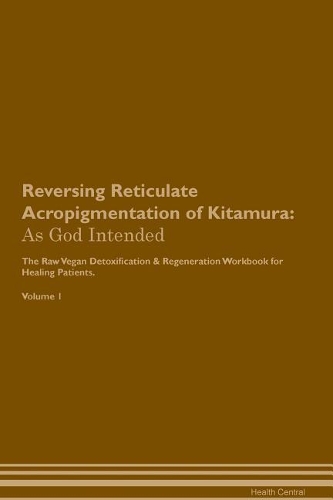 Reversing Reticulate Acropigmentation of Kitamura