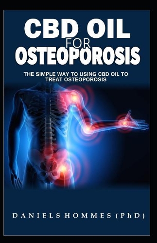 CBD Oil for Osteoporosis: The Simple Way to Using CBD Oil to Treat Osteoporosis