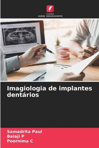 Imagiologia de implantes dentários