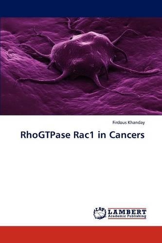 RhoGTPase Rac1 in Cancers: (English)