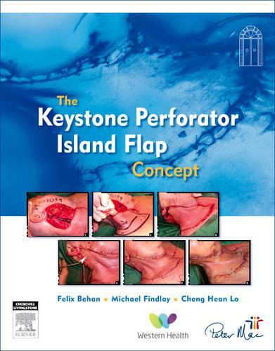 The Keystone Perforator Island Flap Concept