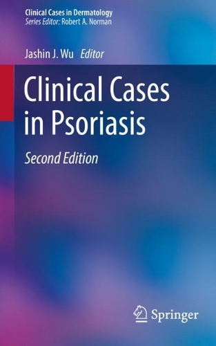 Clinical Cases in Psoriasis: (Clinical Cases in Dermatology)
