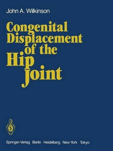 Congenital Displacement of the Hip Joint: (English)