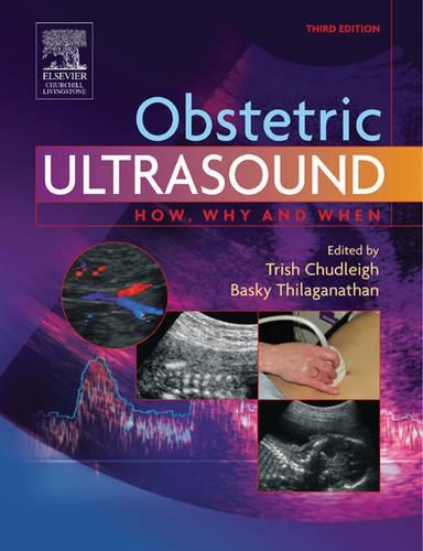 Obstetric Ultrasound